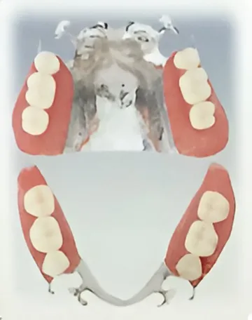 ハイグレードタイプ 純チタン・チタン合金