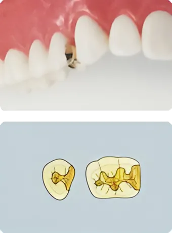 スタンダードタイプ ゴールド